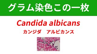 今日のグラム染色この一枚 Candida albicansによる菌血症