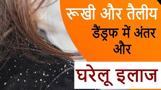 रूखी और तैलीय डैंड्रफ में अंतर और घरेलू इलाज  Difference Between Dry and Oily Dandruff |