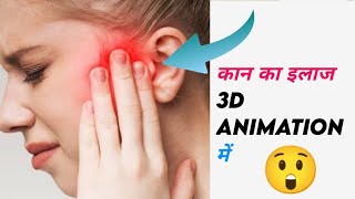 कान का इलाज 3D ANIMATION में #shorts #facts #viral #short #trending #fact #amazing #youtube