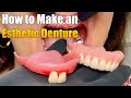 How To Make An Esthetic Denture