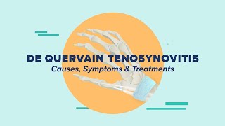 De Quervain Tenosynovitis