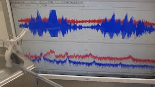 超音波技術開発ーーキャビテーションと音響流に関する基礎実験（超音波システム研究所）