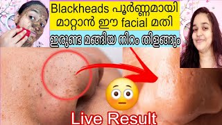 😳ഇത്രയ്ക്കും എളുപ്പമായിരുന്നോ😃For Bright Skin💯Working homeremedy😲How to remove blackheads