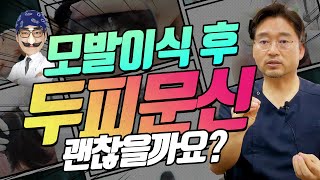 모발이식 후 두피 문신해도 문제 없을까