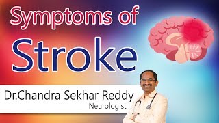 Hi9 | Symptoms of stroke | Dr.Chandra Shekar Reddy | Neurologist