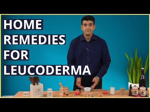 3 Best LEUCODERMA (VITILIGO) Treatments At Home With Natural Remedies 3 Best LEUCODERMA (VITILIGO) Treatments At Home With Natural Remedies