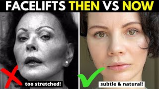 The Evolution of Facelifts: Why CURRENT Facelift Advancements Will Give You Soft and Natural Results