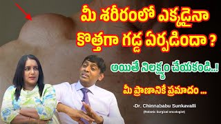 మీ శరీరంలో ఎక్కడైనా కొత్తగా గడ్డ ఏర్పడిందా ? అయితే నిలక్ష్యం చేయకండి...మీ ప్రాణానికే ప్రమాదం...