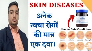 त्वचा रोग व उपचार | skin allergy | tvacha rog ke upay | twacha rog | skin disease | #skin