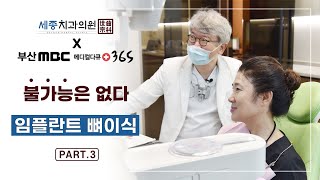 MBC 메디컬다큐365 - 불가능은 없다! 임플란트 뼈이식 part.3