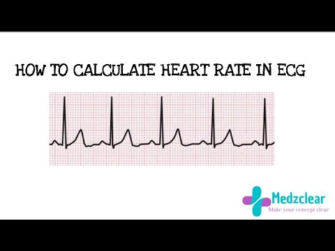 Easy Way To Calculate Heart Rate On ECG/EKG ( 6 Second Strip) - YouTube