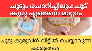 ചൂടും ചൊറിച്ചിലും: ചൂട് കുരു എങ്ങനെ മാറ്റാം