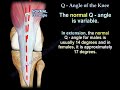 q angle of the knee everything you need to know dr. nabil ebraheim