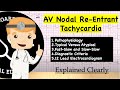 AV Nodal Re-Entrant Tachycardia (AVNRT) - Pathophysiology, Typical Versus Atypical, ECG Diagnosis