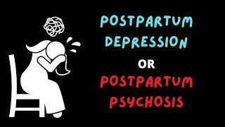 POSTPARTUM BLUES (OBGYN review)