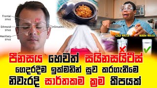 පීනස හෙවත් සයිනසයිටීස් ඉක්මනින් සුවකරගැනීමට නිවැරදි ක්‍රම|sinasitis|thorathuru