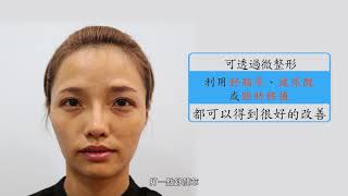 【玉貴人診所醫師專業解析】30歲前美魔女養成術-周宏彰醫師