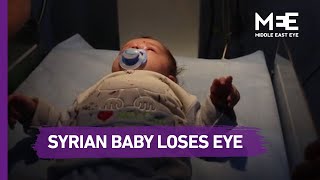 Syrian baby loses eye