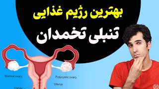 برای تنبلی تخمدان چه بخوریم؟ علائم و روش های درمان سندرم تخمدان پلی کیستیک