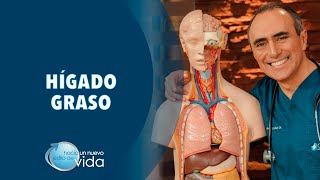 HÍGADO GRASO - HACIA UN NUEVO ESTILO DE VIDA