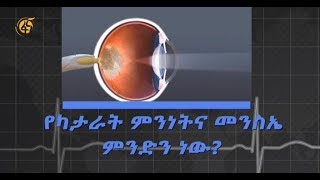 በአይን ሞራ ግርዶሽ ዙሪያ የዘርፉ ባለሙያዎች ምን ይላሉ?