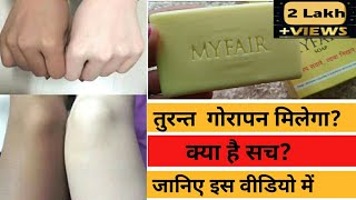 Skin whitening Soap | Myfair Soap Review | Best Fairness Soap | Skin Lightening Soap | Myfair