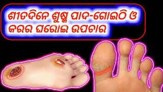 ଶୀତଦିନେ ଶୁଷ୍କ ପାଦ-ଗୋଇଠି ଓ କରର ଯତ୍ନ | Sitadine pada ra jatna | Winter season foot care