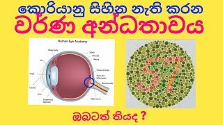 Color Blind test sinhala- වර්ණ අන්ධතාවය