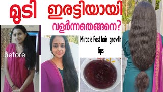 മുടി വേഗത്തിൽ വളരാൻ ഇതു ചെയ്യൂ ..../fast hair growth tip