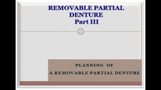 PLANNING  OF A REMOVABLE PARTIAL DENTURE