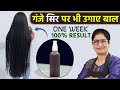 कितने भी खराब बालों का झड़ना रोक कर - उगाये नए बाल | DIY Serum, Pack & Drink for Extreme Hair Growth