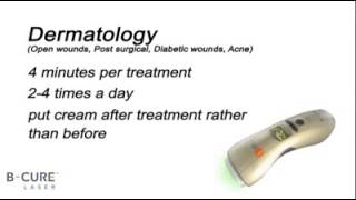 Dermatology treatment with B-Cure laser