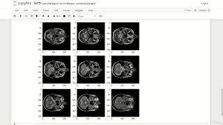 5 NIfTI in Python