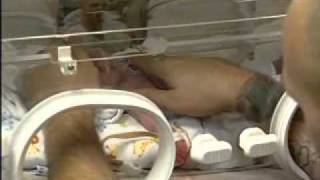 Family-Centered Care at the Neonatal Intensive Care Unit - NICU