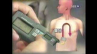 2001. 12. 25. SBS뉴스_건강리포트_당뇨, 잘 먹으면서 치료한다