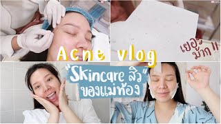 Acne Vlog แม่ท้องไปคลินิกได้มั้ย?+สกินแคร์ที่ใช้ช่วงเป็นสิว(ไม่ท้องก็ใช้ได้ค่า) โนสปอน║Evefee