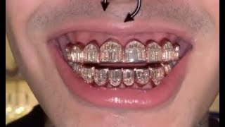 Lil Pump Spends $1M On Rose Gold Baguette Diamond Grill