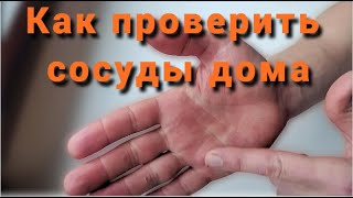 Как проверить сосуды в домашних условиях