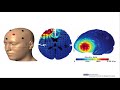 personal brain management for optimal aging robert bilder tedxucla