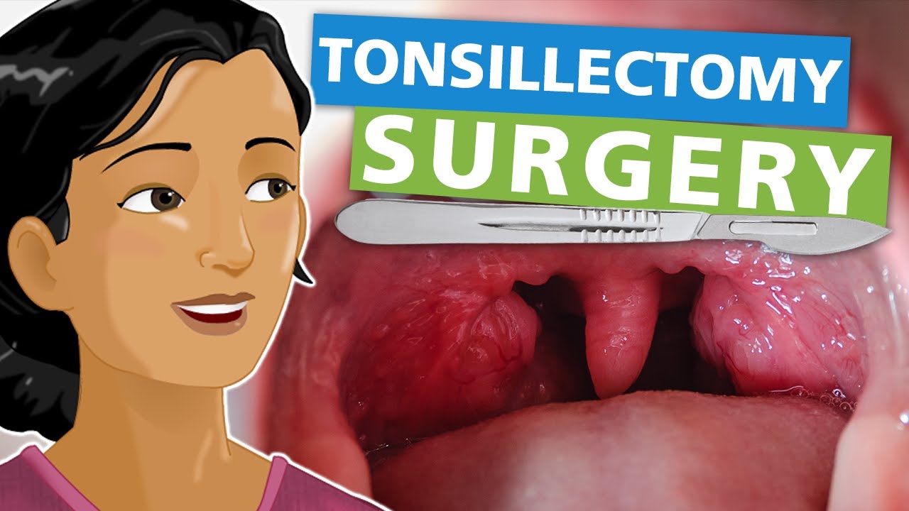 Stomach Pain After Tonsillectomy