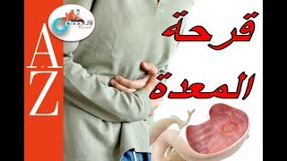 Peptic ulcer |From A to Z | قرحة المعدة والاثني عشر | الاسباب والاعراض والعلاج