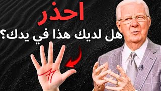 المعنى الحقيقي لحرف M على اليد والذي لم يكشفه لك أحد بعد! بوب بروكتور