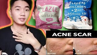 The truth about FROZEN COLLAGEN and LAZEL GLUTA PURE