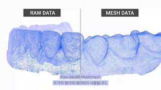 口腔内スキャナー ソフトウェア Medit Link スキャンデータについて