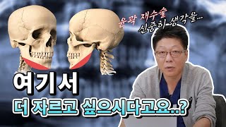 윤곽재수술 상식적으로 가능한가요..? 윤곽재수술에 대한 솔직한 이야기😦😦 #윤곽재수술