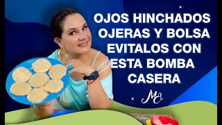 OJOS HINCHADOS, OJERAS Y BOLSA EVITALOS CON ESTA BOMBA CASERA