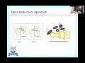 Management of Fracture Neck Femur in Children by Dr Sandeep Vaidya