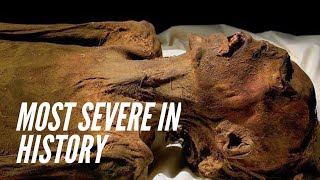 Worst Viruses in Ancient and Medieval Era | Ancient History Documentary