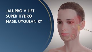 Jalupro  V-Lift Super Hydro Nasıl Uygulanır?