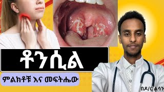 ቶንሲል ምልክቶቹ  እና መፍትሔው | በዶ/ር ልሳን